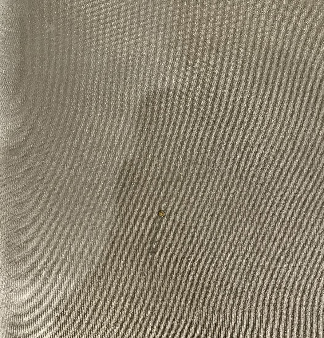 Detalhe do assento direito, mostrando de perto o furo pequeno deixado por uma brasa de cigarro.